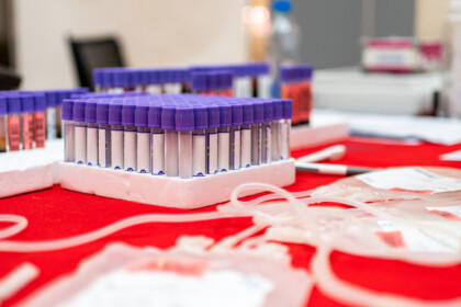 Blood Collection Tubes